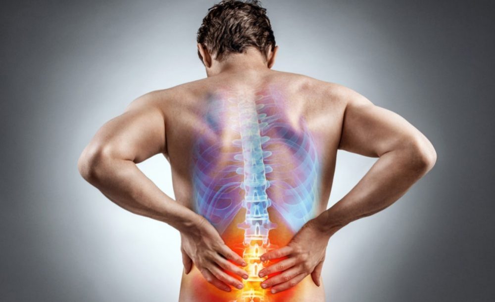 Disc prolapse and sciatica